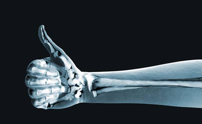 10 loại thực phẩm giúp cho xương chắc khỏe - Nét Bút Tri Ân